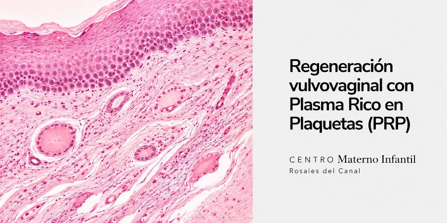 Regeneración vulvovaginal